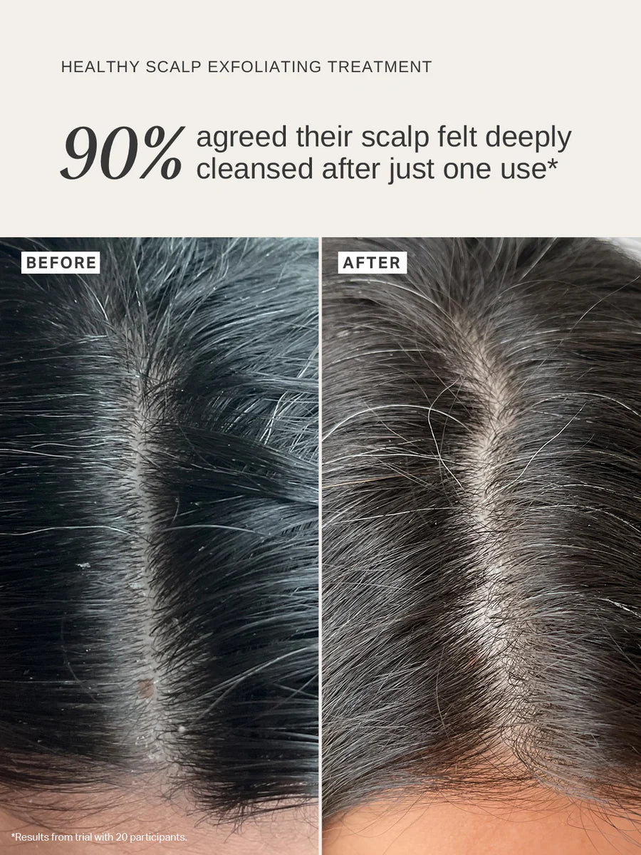 Alpha H - Healthy Scalp Exfoliating Treatment - The Pure Beauty Shop