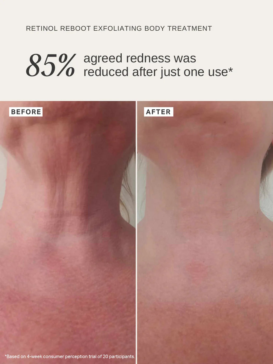 Alpha H - Retinol Reboot Exfoliating Body Treatment - The Pure Beauty Shop