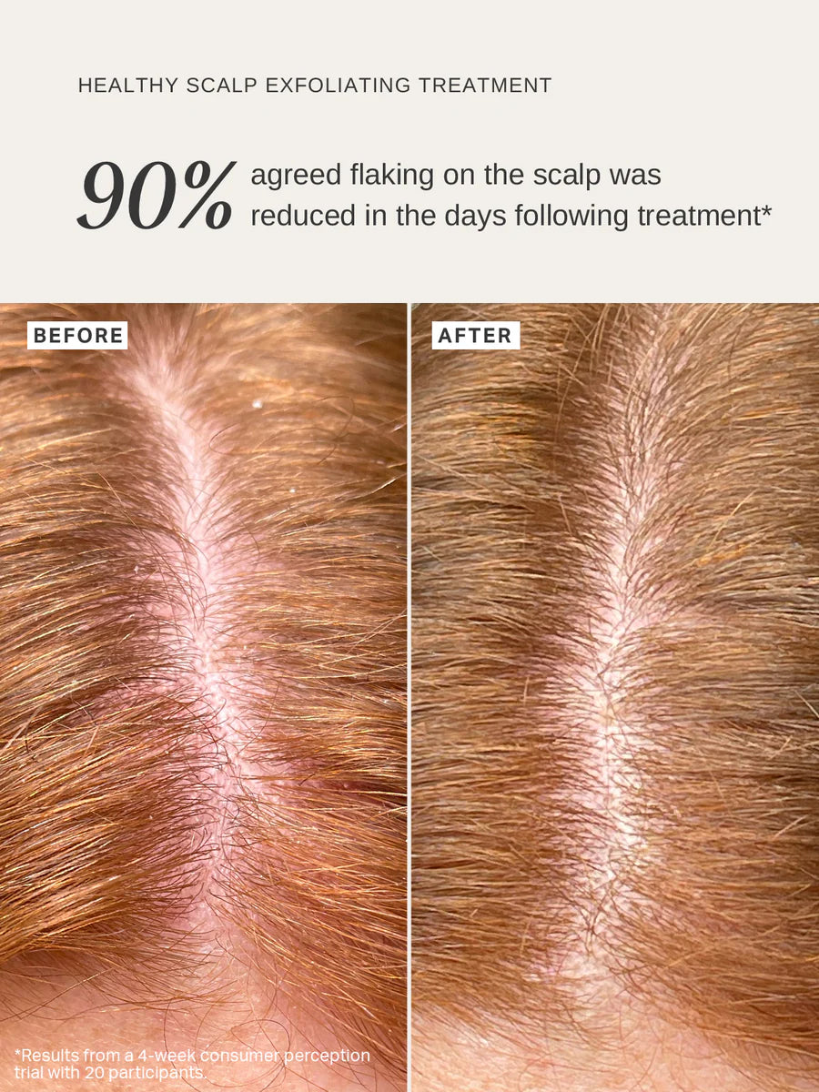 Alpha H - Healthy Scalp Exfoliating Treatment  - The Pure Beauty Shop