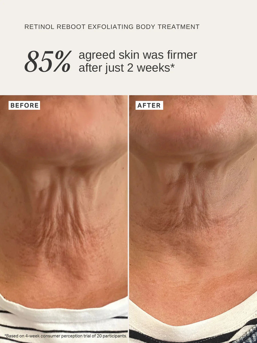 Alpha H - Retinol Reboot Exfoliating Body Treatment - The Pure Beauty Shop