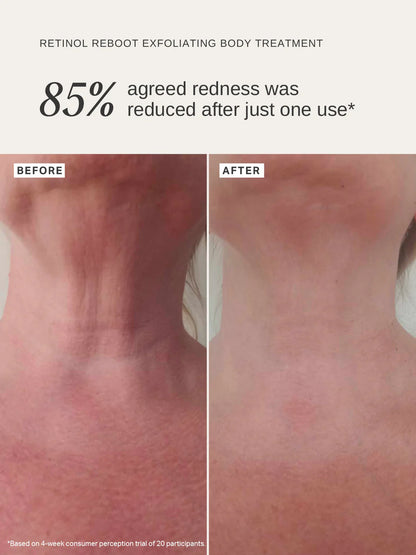 Alpha H - Retinol Reboot Exfoliating Body Treatment - The Pure Beauty Shop