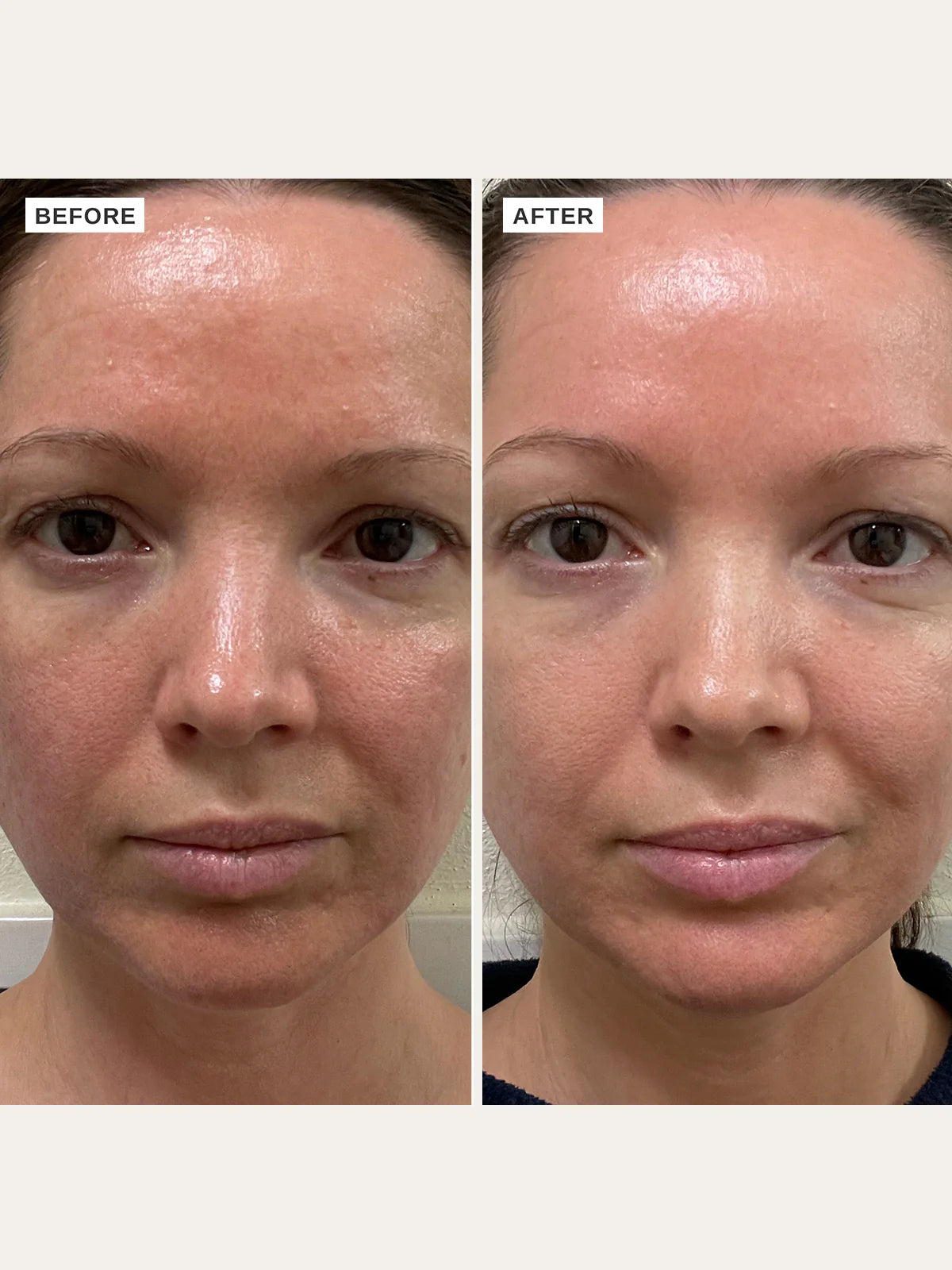 Alpha H - Vitamin B Serum - The Pure Beauty Shop
