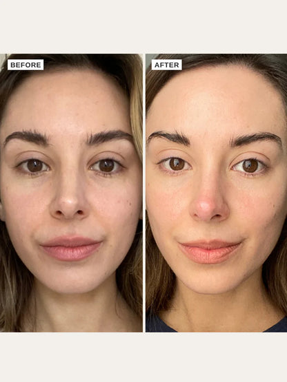 Alpha H  - Vitamin C Serum - The Pure Beauty Shop