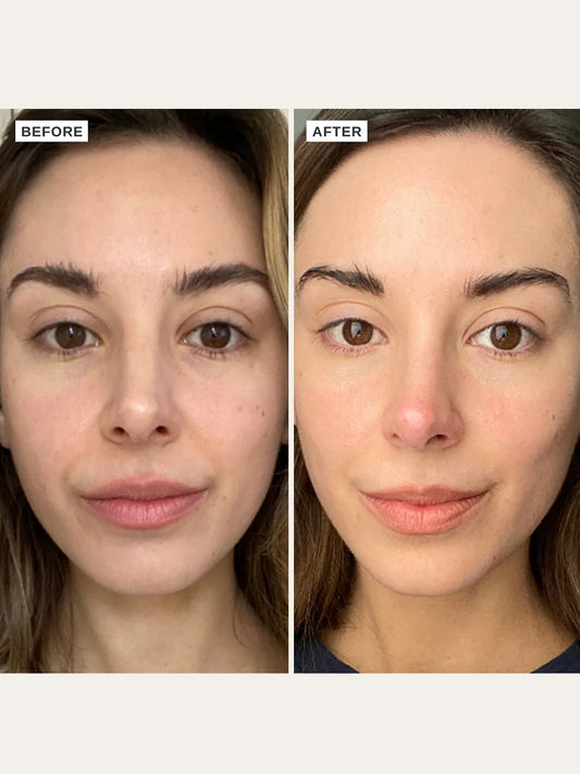 Alpha H  - Vitamin C Serum - The Pure Beauty Shop