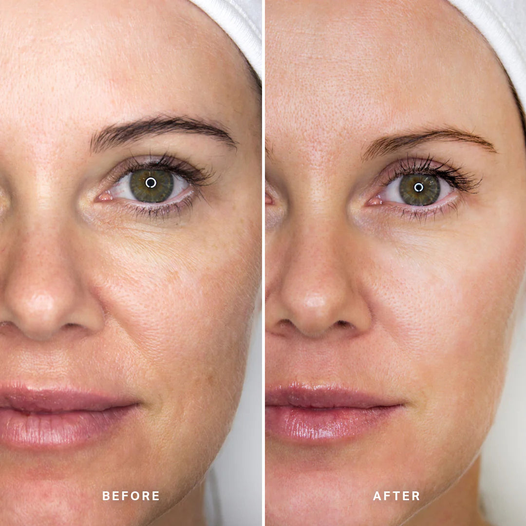 Alpha H - AHA Glow Duo - The Pure Beauty Shop