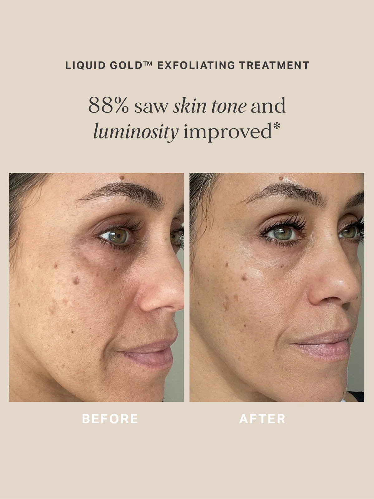 Alpha H - Liquid Gold Exfoliating Treatment - The Pure Beauty Shop