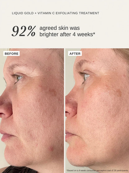 Alpha H - Liquid Gold + Vitamin C Exfoliating Treatment - The Pure Beauty Shop