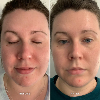 Alpha H - Vitamin A Serum - The Pure Beauty Shop