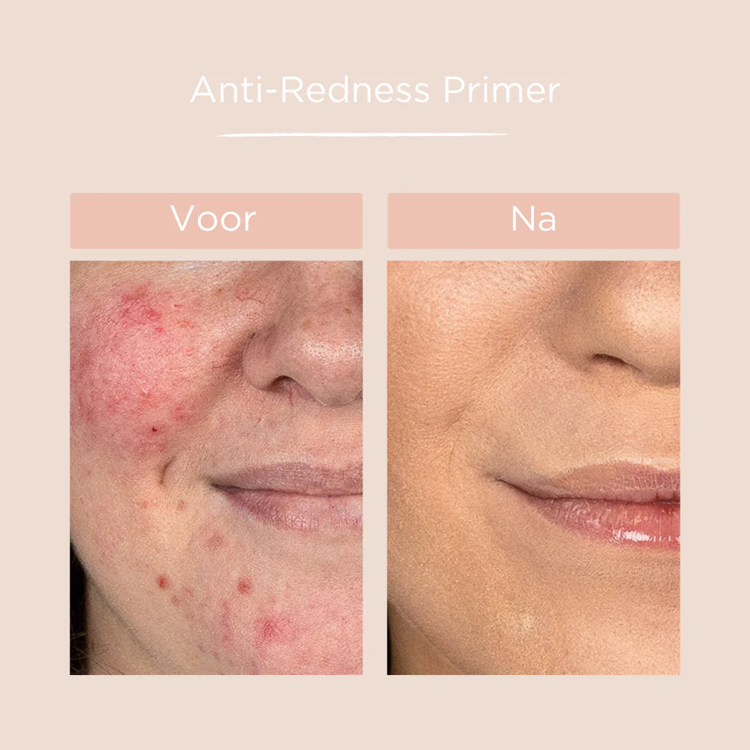 Cent Pur Cent - Anti Redness Primer - The Pure Beauty Shop